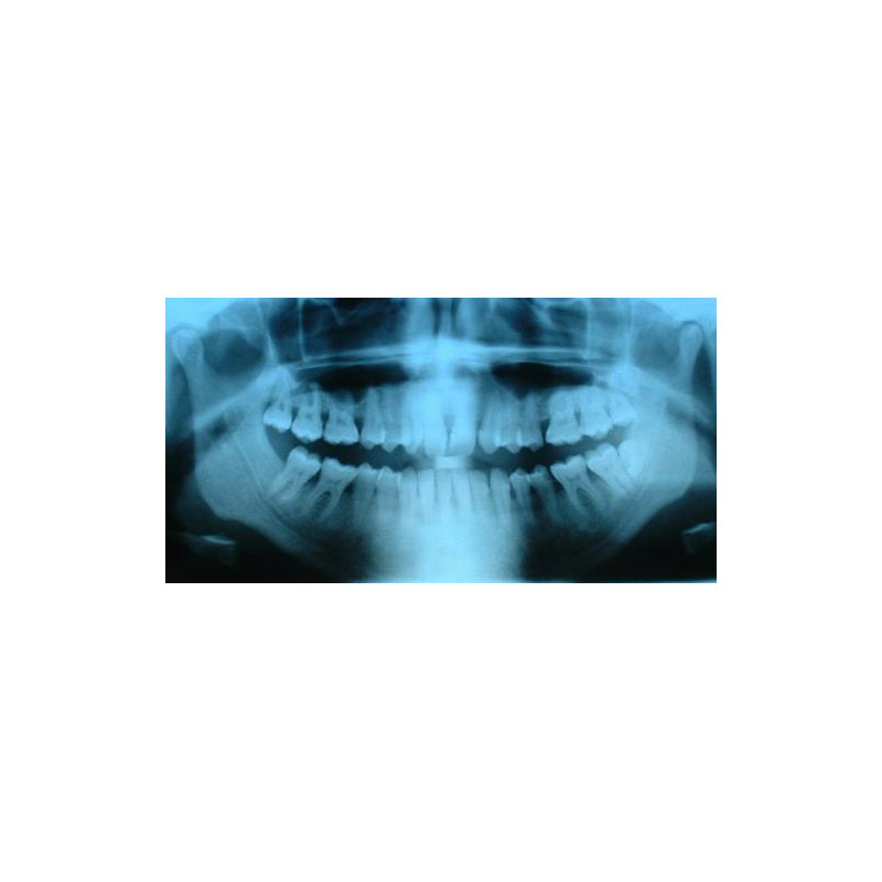 Radio de dents Radio de dents